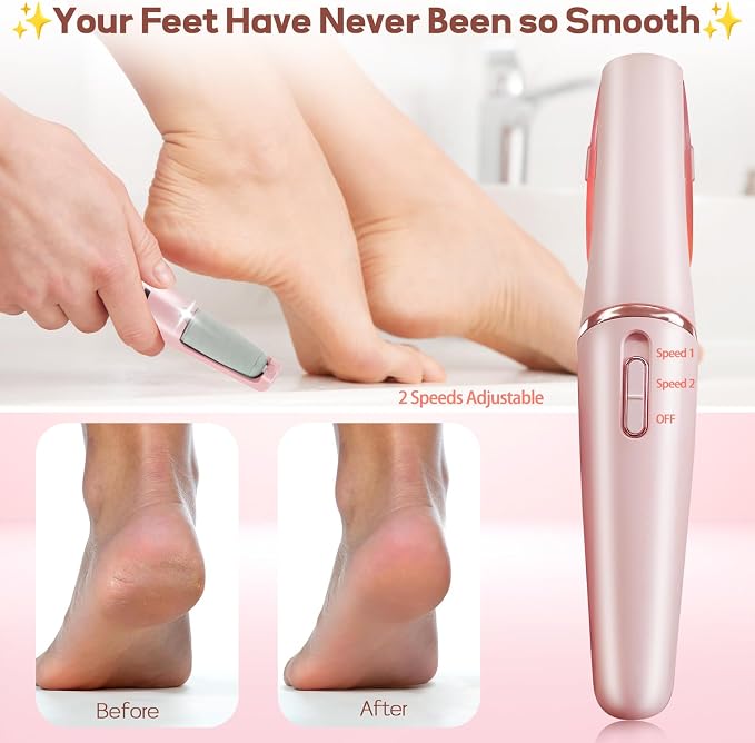 Electric Callus Removers for Feet, Rechargeable Electric Foot Callus Remover Pedicure, Removes Dry Skin for Smoother Feet, Foot Care for Dead Skin Ideal Gift (Pink)